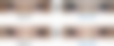 【韩国吴金斯整形医院诊疗设备：】