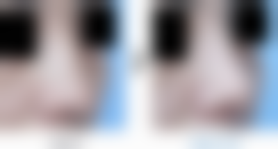 【韩国吴金斯整形医院医生名单：】