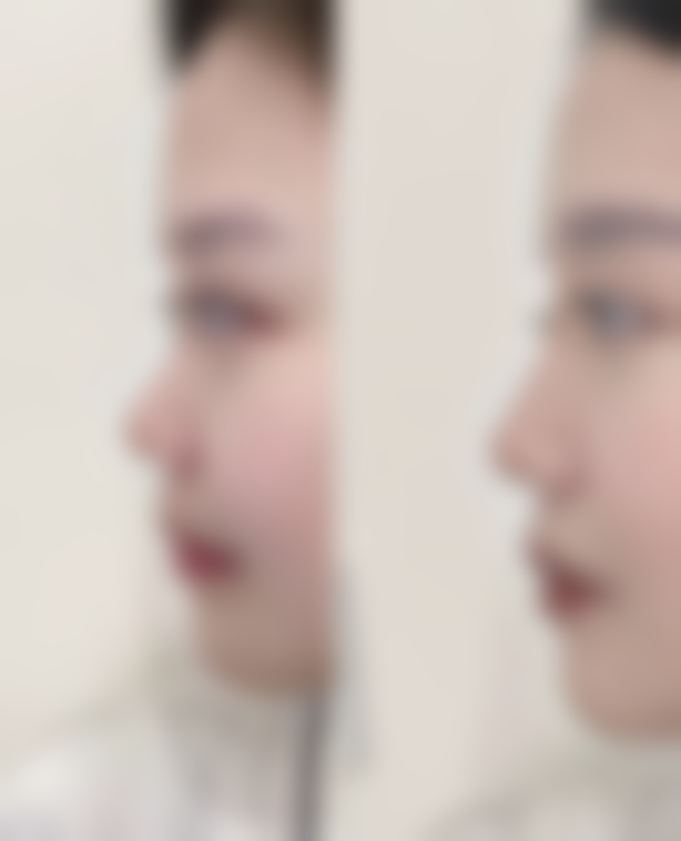 【泸州美馨医学整形美容诊所是正规的吗?】