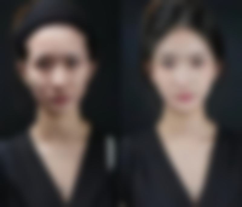 【杭州美知医疗美容诊所患者口碑评价：】