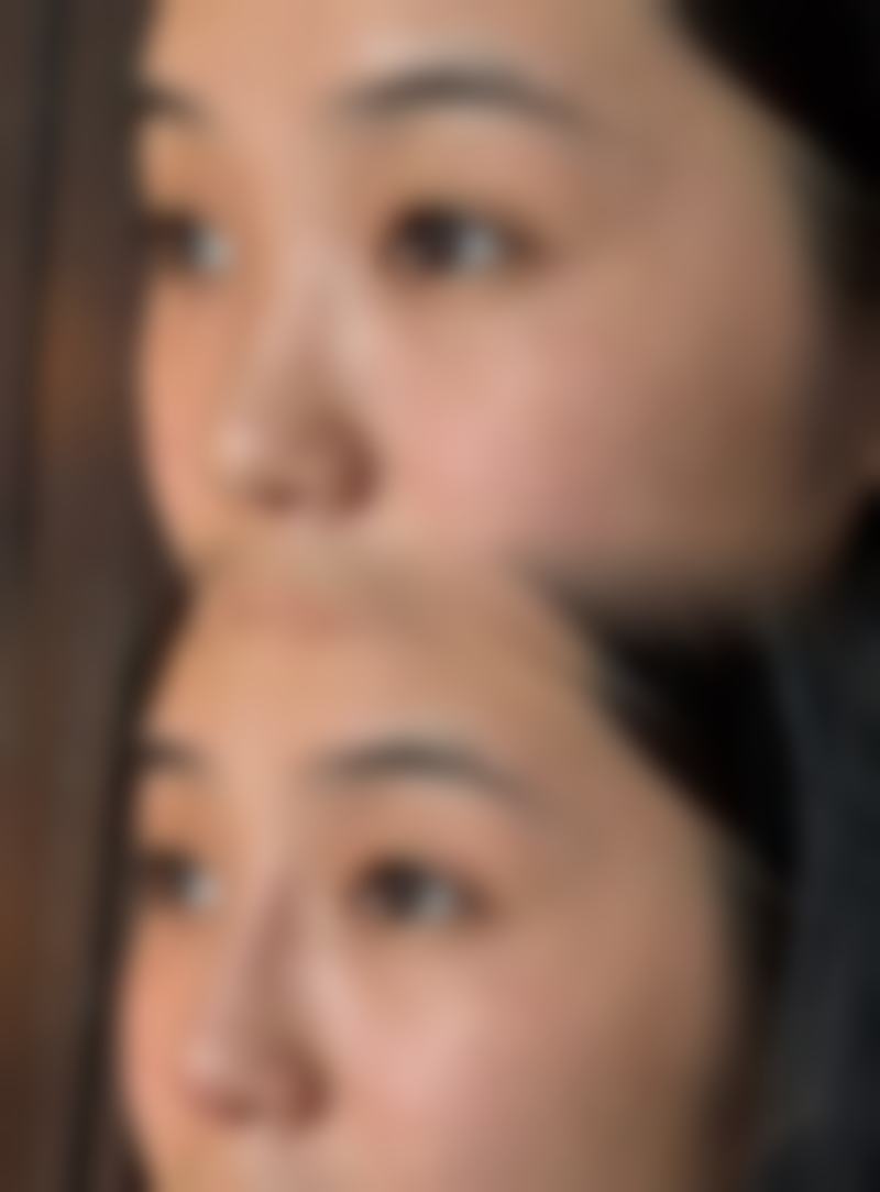 【广州轻轻医美美容诊所怎么预约挂号?】