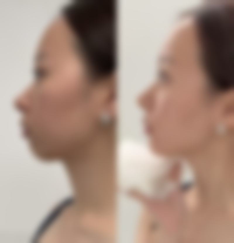 【武汉诠美医疗美容门诊部参考价格表：】