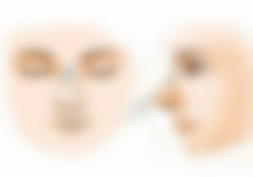 种植头发哪家医院好