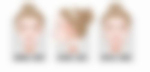 正颌手术可以把脸变短吗