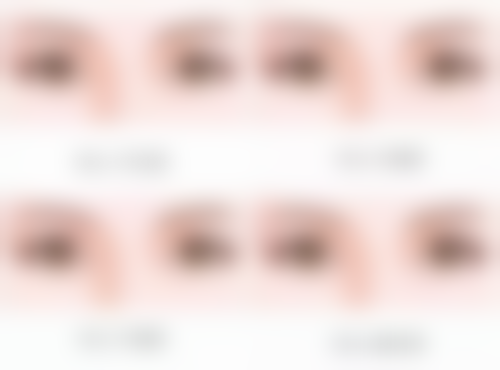 下颌角整形成效好吗