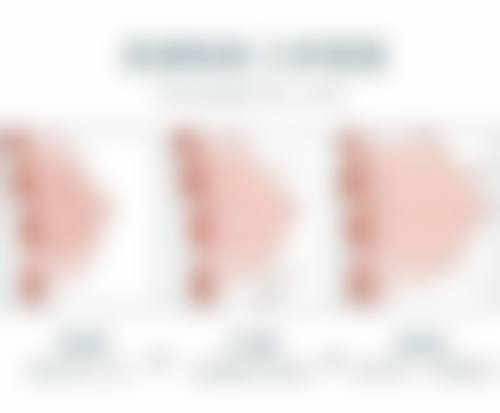 正颌手术的优缺点