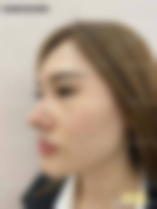 【於光曙医生擅长项目】