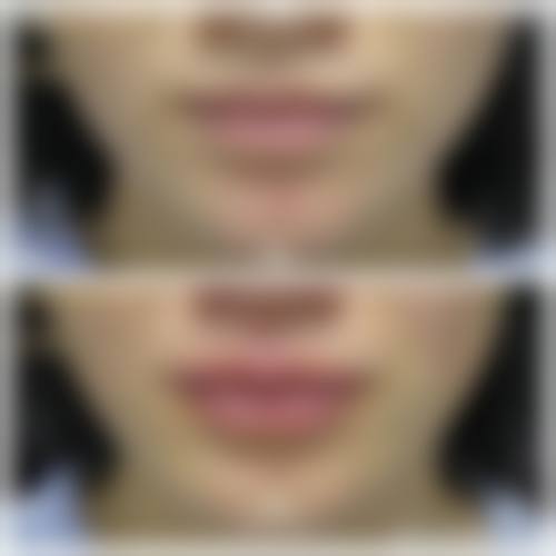 【周口市中 心医院整形是正规的吗?】