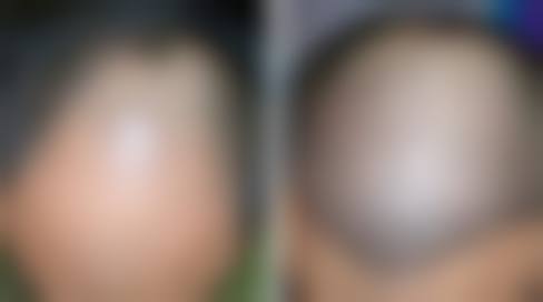 【谢剑医生擅长项目】