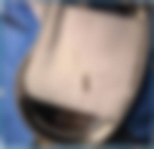 评价二：“我一直对自己的鼻子不太满意，朋友推荐我来菏泽美思慕。到了医院后，医生给我做了详细的检查和分析，制定了个性化的隆鼻方案。手术过程特别顺利，术后成效自然又好看。医院的环境也特别不错，干净整洁，让人感觉特别舒适。真的特别感谢菏泽美思慕让我实现了变得更美的愿望。”