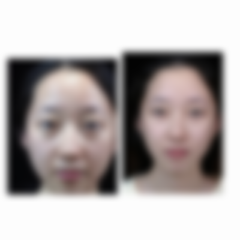 菏泽美思慕整形医疗美容门诊部提供多种整形美容项目，涵盖了眼部整形、鼻部整形、面部轮廓整形、隆胸、吸脂减肥、皮肤美容等多个领域。其中眼部整形可以让你的眼睛更加明亮有神，鼻部整形能打造出精致的鼻型，面部轮廓整形可以改善脸型，让你拥有小巧精致的脸蛋。隆胸手术可以提升胸部的丰满度和挺拔度，吸脂减肥则能帮助你快速塑造理想身材。皮肤美容项目包括激光祛斑、光子嫩肤、水光针等，能够有效改善皮肤的质地和色泽，让肌肤焕发出健康的光彩。