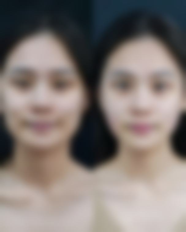 评价一：“我在菏泽美思慕做了眼部整形手术，成效真的超出了我的预期。医生非常专精，术前和我沟通得特别详细，根据我的眼部情况设计了更适合我的方案。术后修复得也特别快，现在眼睛又大又有神，真的太满意了！而且医院的服务也特别好，护士小姐姐们都特别贴心，让我在整个过程中都感到特别安心。”