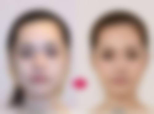 嘴唇厚怎么变薄