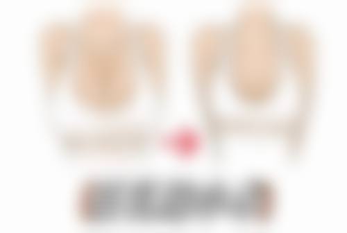 嘴唇厚怎么改善