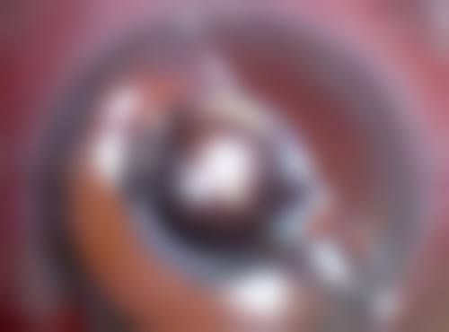 嘴唇厚怎么办才能变薄