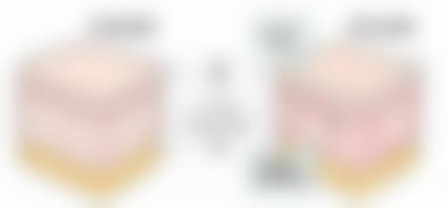 如何选择适合自己的医美除皱方法