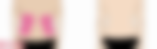 瘦脸针打完多久见效