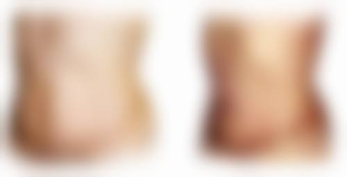 种植的胡须剃掉特别不自然