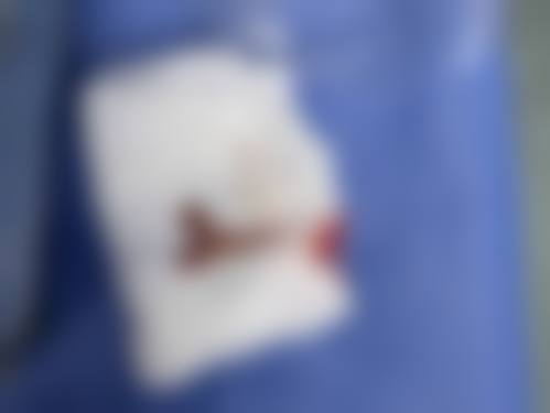 【徐州云龙美玲医学美容诊所怎么预约挂号?】