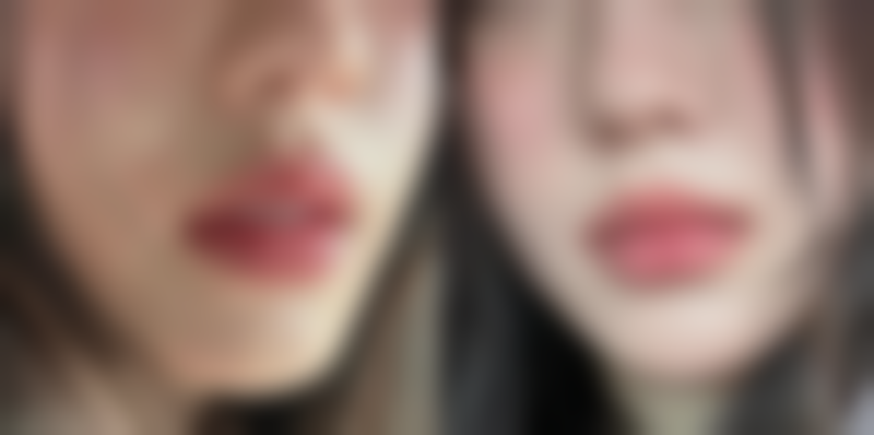 【沈阳吴慧舫医疗美容诊所参考价格表:】