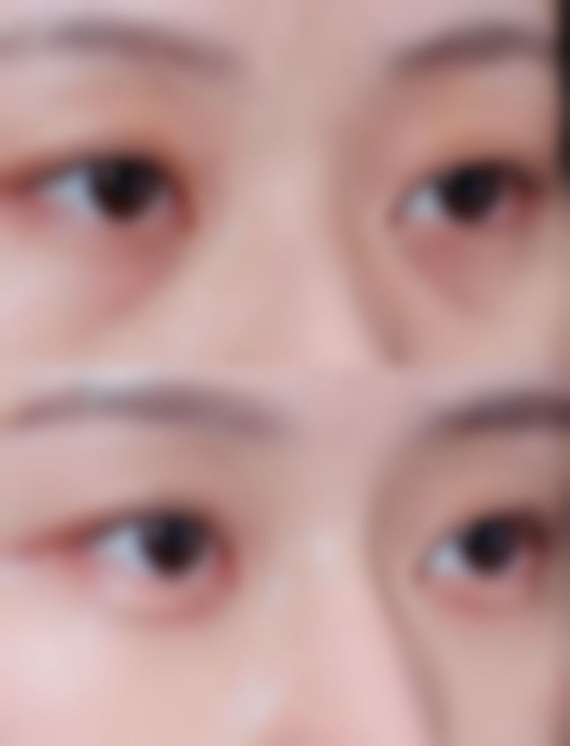 种胡须多久能修复