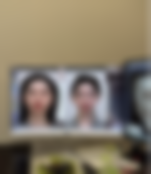 瘦脸针一般打几次