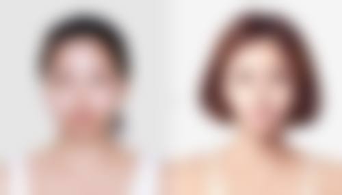 打咬肌瘦脸针有副作用吗