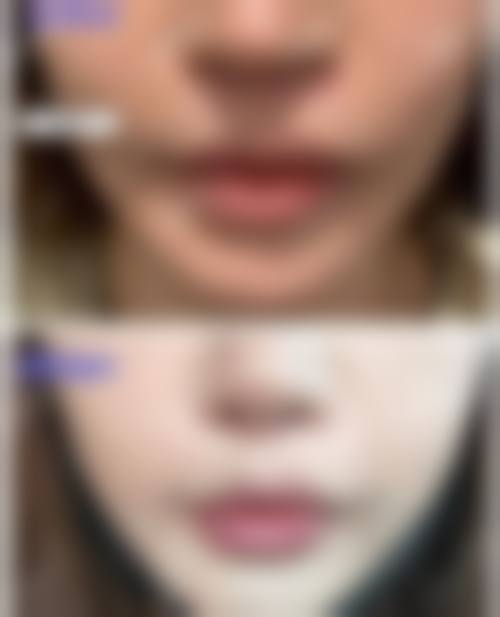 【青岛简一整形医院参考价格表:】