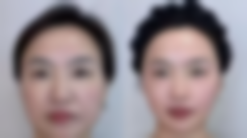 【深圳和平医院医疗美容科地址:】