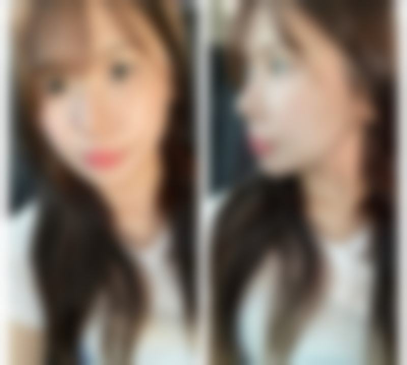 【深圳和平医院医疗美容科患者口碑评价:】