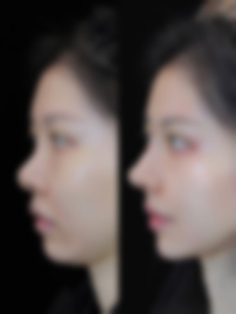 【青岛简一整形医院怎么预约挂号?】