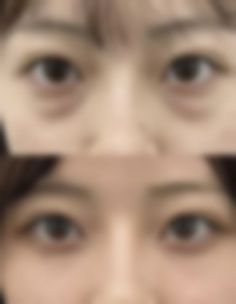 【深圳和平医院医疗美容科特色项目:】