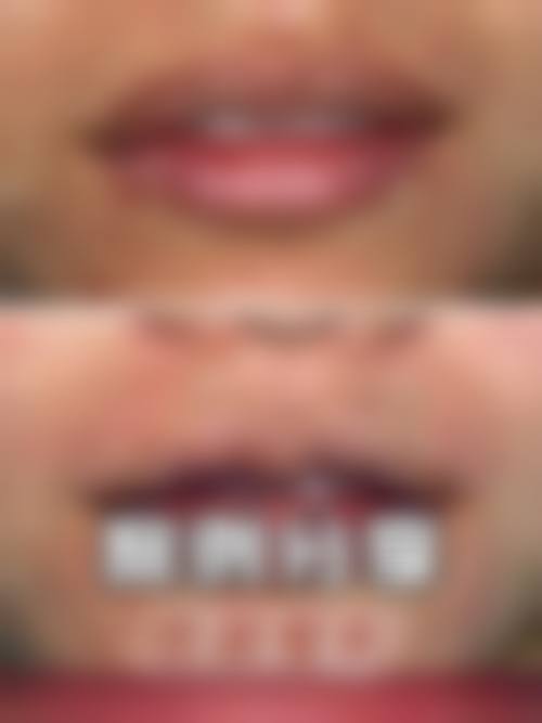 【乌鲁木齐金太平洋医疗美容特色项目：】