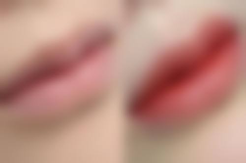 【北京国丹医院拇外翻外科医生名单：】