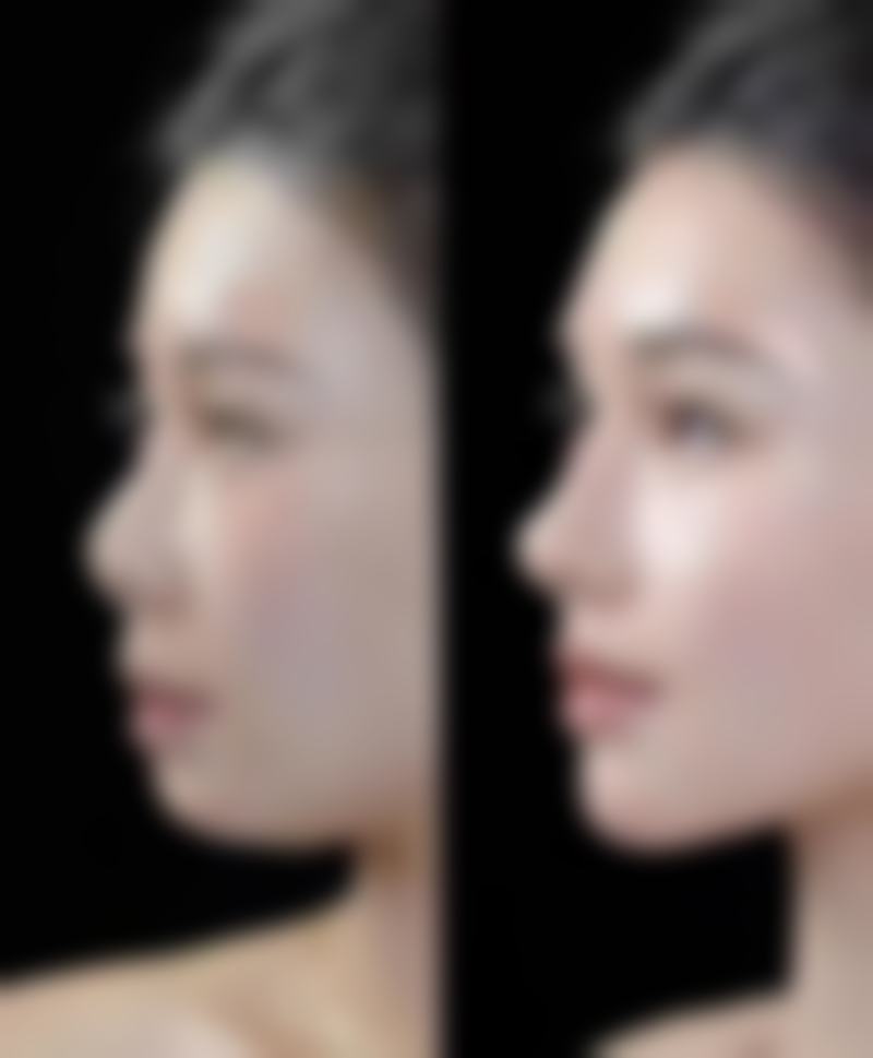 【深圳回来医疗美容患者口碑评价:】