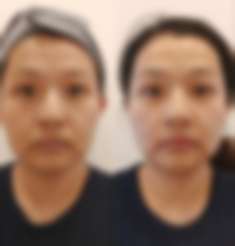 该科室的特色项目丰富多样，涵盖了整形美容、微整形和激光美容等多个领域。整形美容项目包括眼部整形、鼻部整形、乳房整形、吸脂减肥、五官整形、颌面整形、拉皮除皱、私密整形等；微整形项目有面部塑形、眉间纹、额纹、抗衰老、法令纹、泪沟纹等；激光美容项目包含面部祛斑、彩光嫩肤、冰点微痛脱毛、射频除皱、祛太田痣、激光点痣、疤痕修复等。无论是想要进行整体的形象塑造，还是针对某个部位的细微调整，都能在这里找到适合自己的项目。