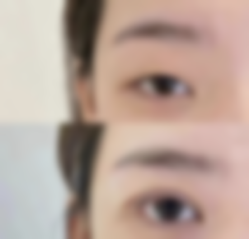 可不可以种植头发