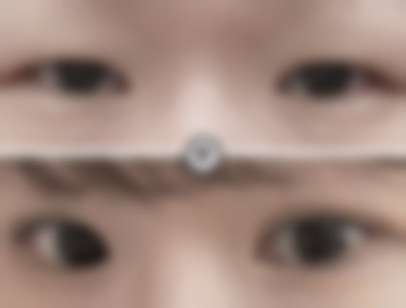 西昌艺佳美整形医院的医疗设备均从海外正规渠道购买。这些设备具有精良性和安心性的特点。精良的设备能够为手术提供更精细的操作，提高手术的成功几率和成效。例如，在皮肤美容项目中，精良的激光设备可以更严谨地针对色斑、痘痘等问题进行治疗，减少对周围皮肤的损伤。在整形手术中，高精度的仪器可以帮助医生更好地把握手术的细节，使手术成效更加自然、美观。同时，设备的安心性也得到了保护，让顾客在接受治疗时更加放心。