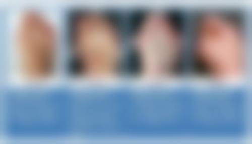 如何选择适合自己的瘦脸方式