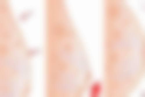 【香港伊莲整形美容医院参考价格表：】