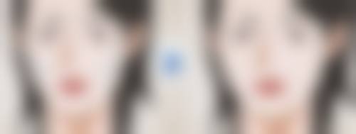 白毒瘦脸针打完注意什么