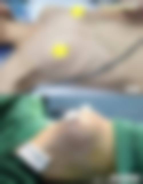 【景德镇市第六人民医院整形美容科诊疗设备:】