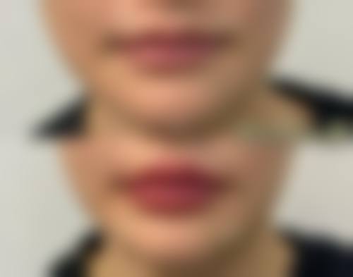 【香港伊莲整形美容医院医生名单：】