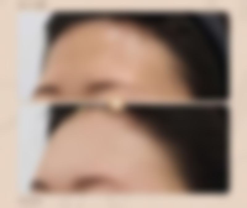 不同品牌瘦脸针价格表