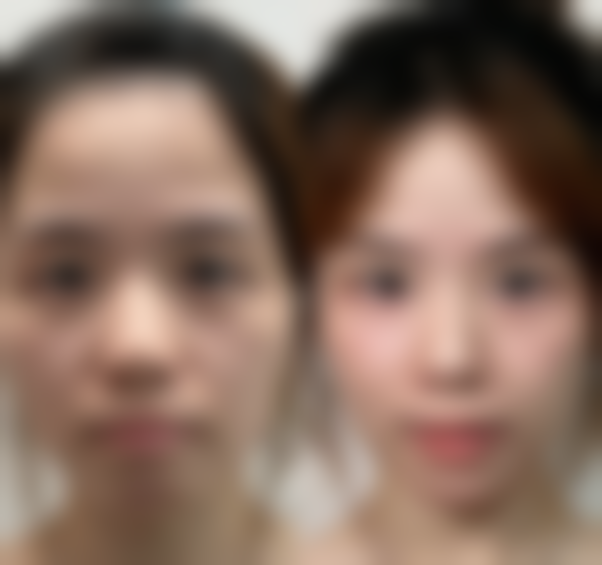 【阜阳悦美医疗美容门诊部特色项目：】