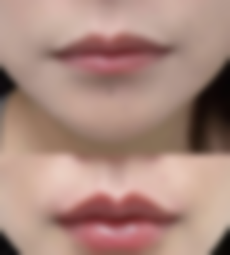 白毒瘦脸针对身体有害吗