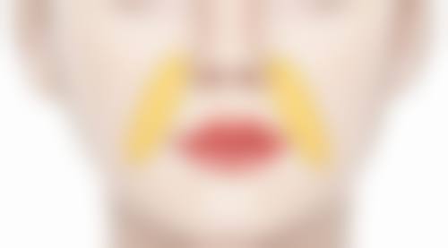 除皱针的至佳成效在注射后多久?