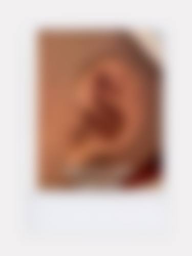 【郑州延丽整形医院特色项目：】