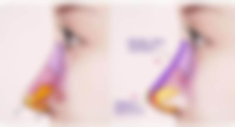 【曾江医生技术特点：】