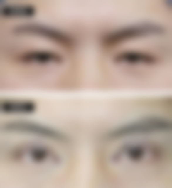 【潮州博兰雅整形医院地址:】